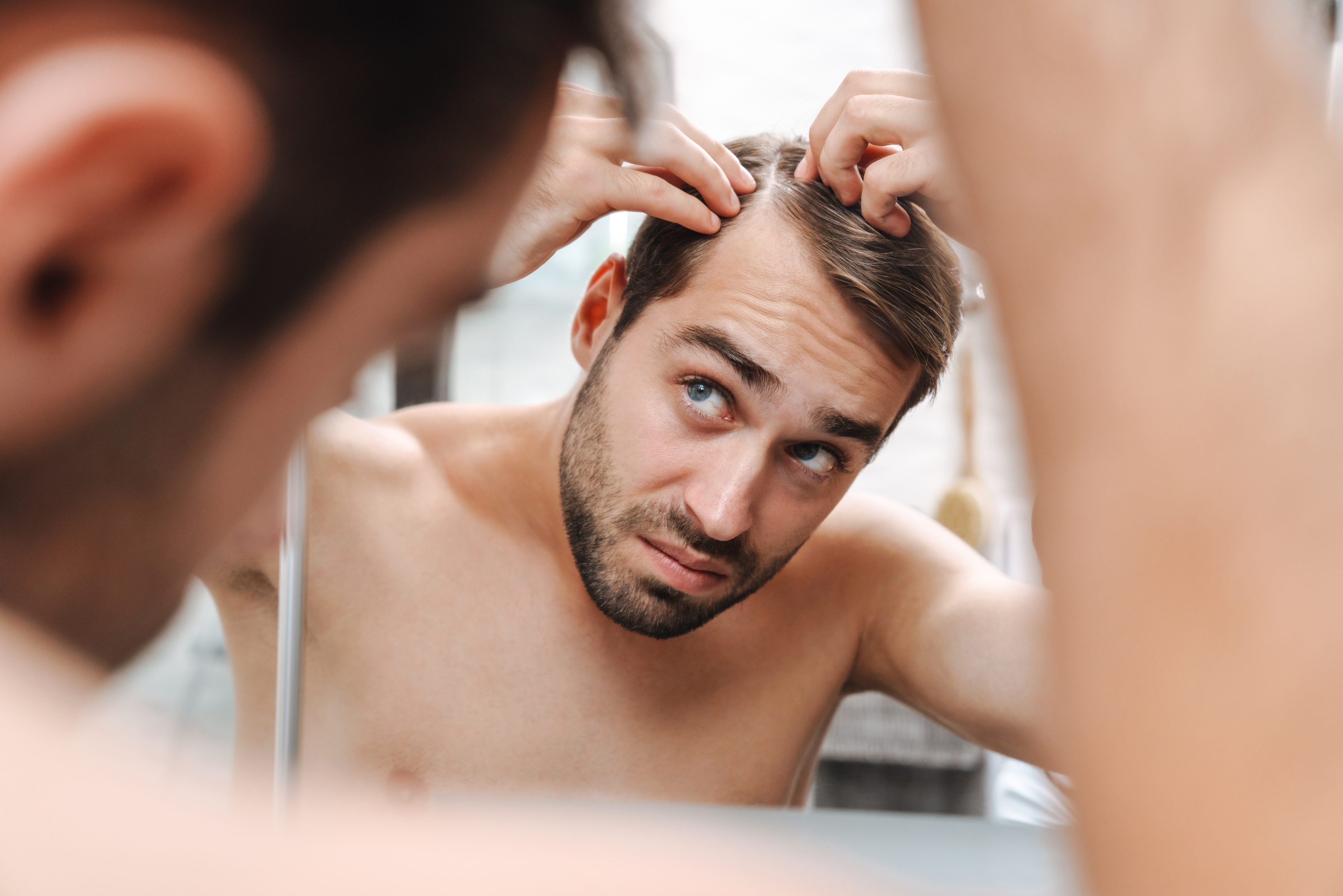 A man worried about a receding hairline.