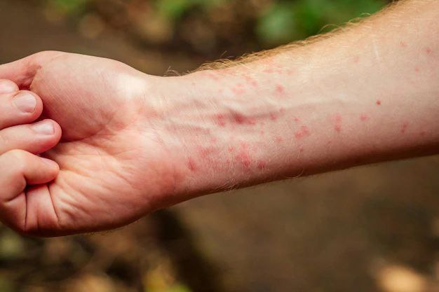 how to treat skin problems caused by a skin infection 