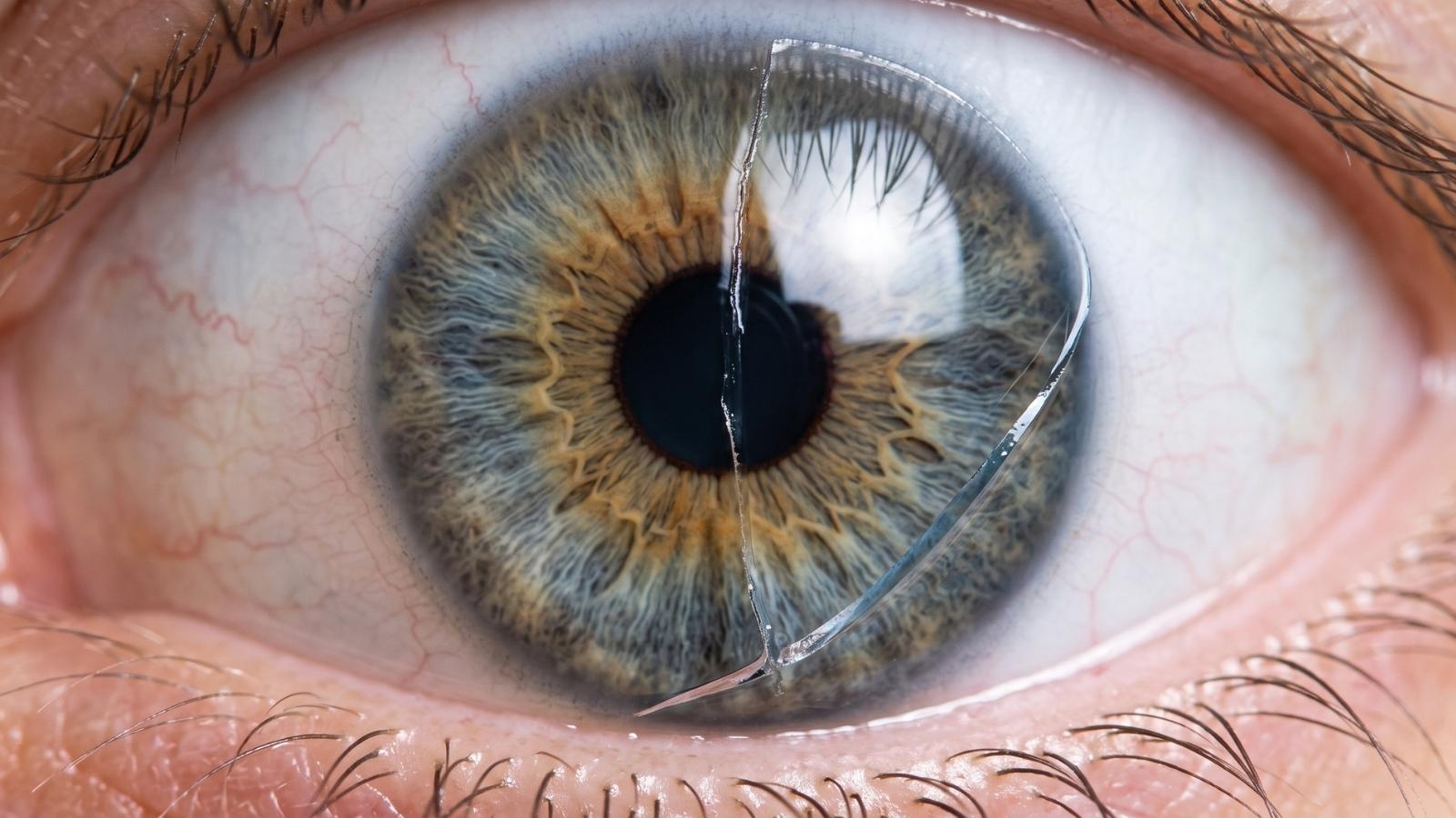 stuck soft contact lens