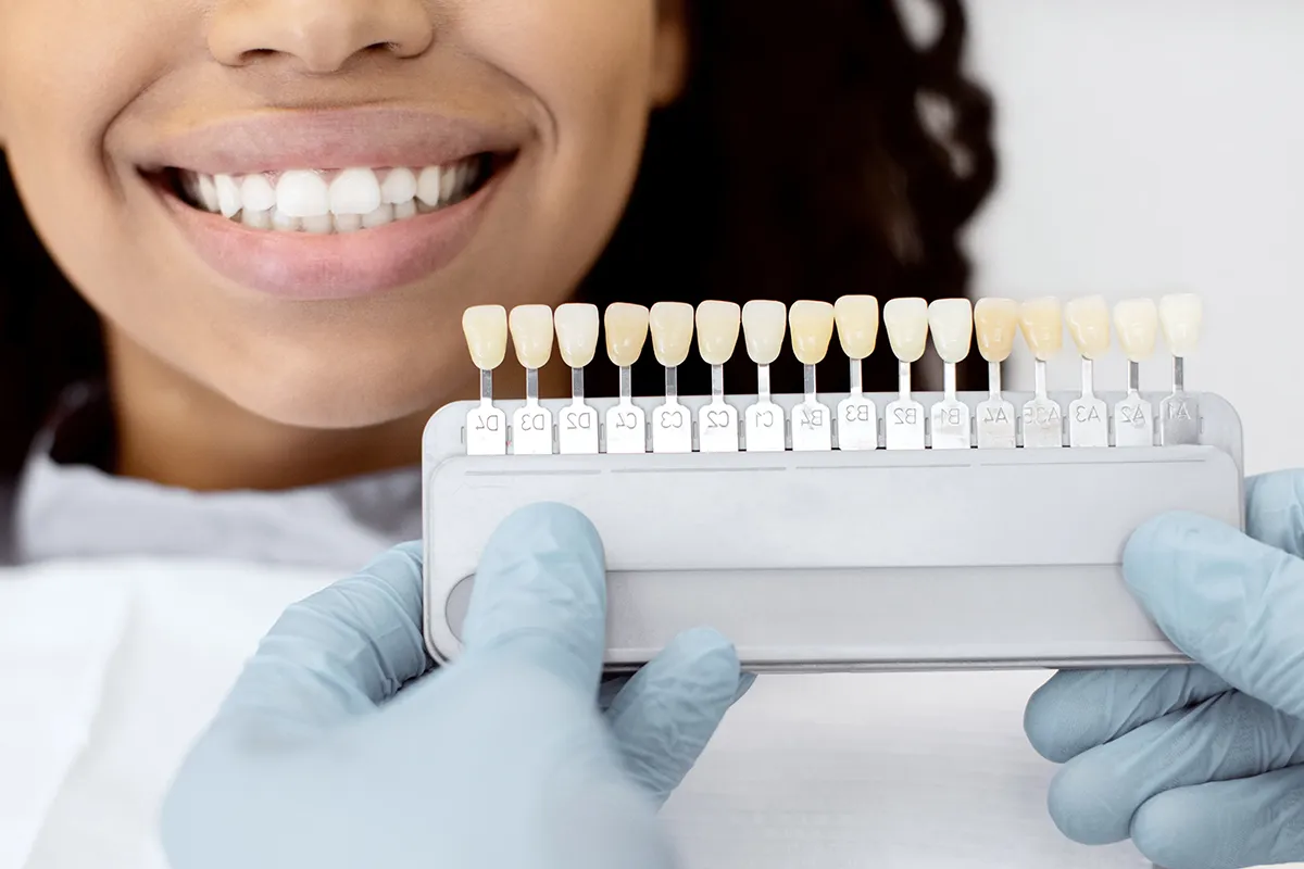 Dentist matching tooth shade guide to patient's natural teeth color.