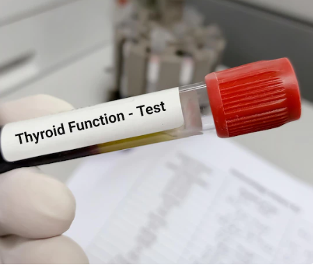 test sanguin thyroïdien