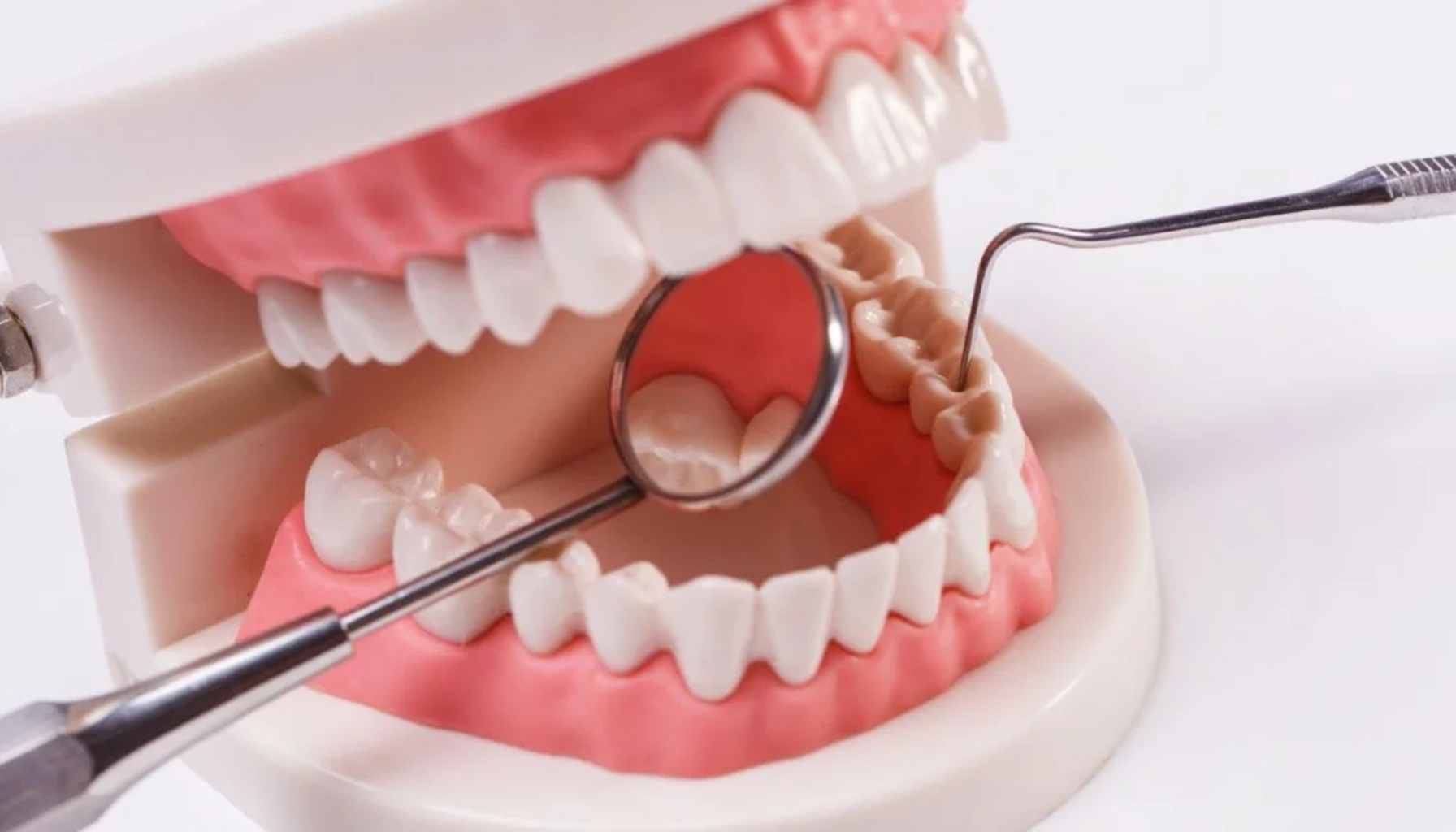 Hvor mye koster det å bore hull? Se pris og alternativer 18 Tannmodell med åpne kjever undersøkes med tannlegeinstrumenter, viser tenner og tannkjøtt i undervisnings- eller behandlingssammenheng.