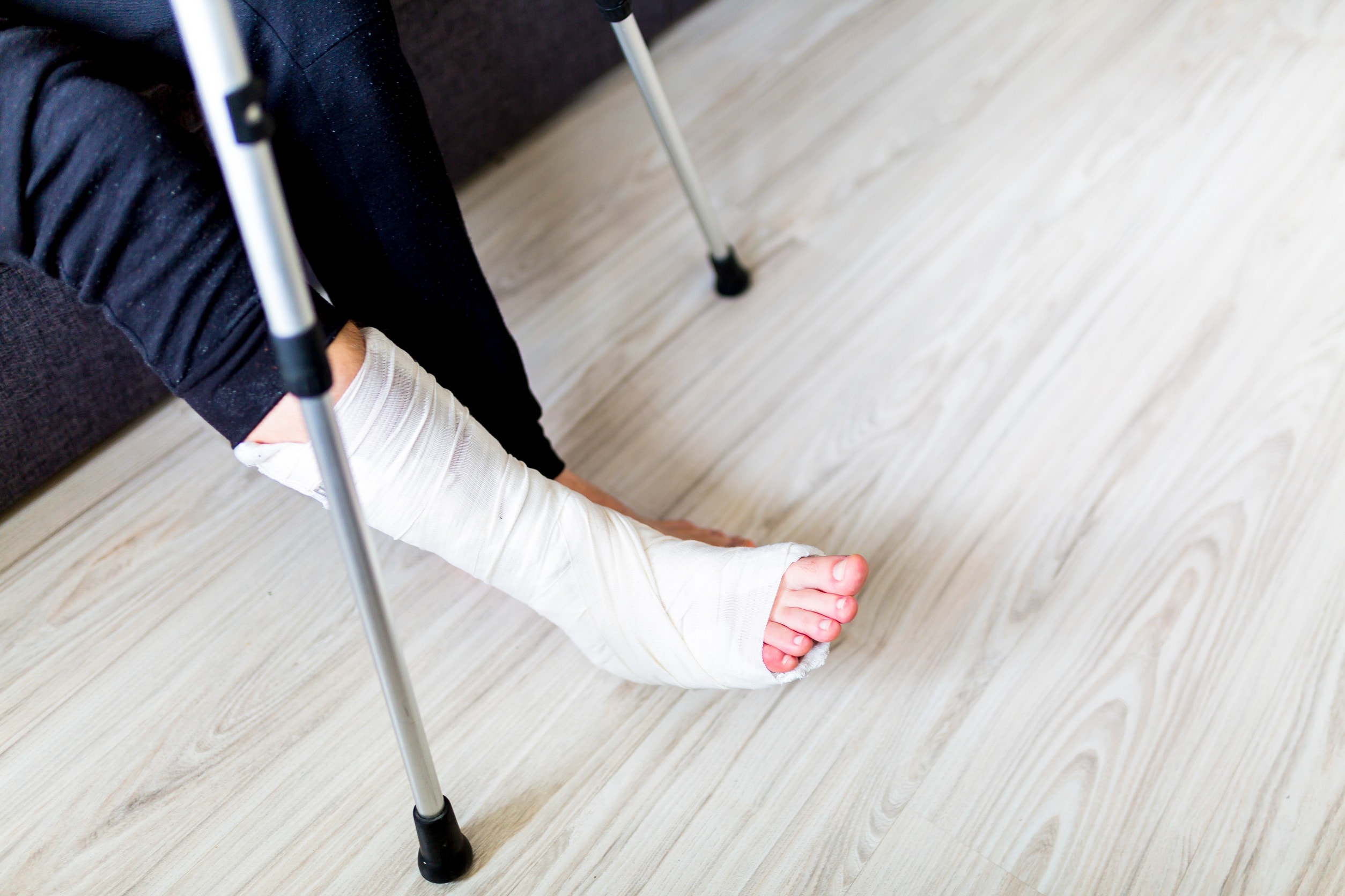 A man on a couch with a serious fracture injury wrapped in a cast