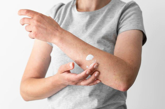 when and how to use hydrocortisone cream 