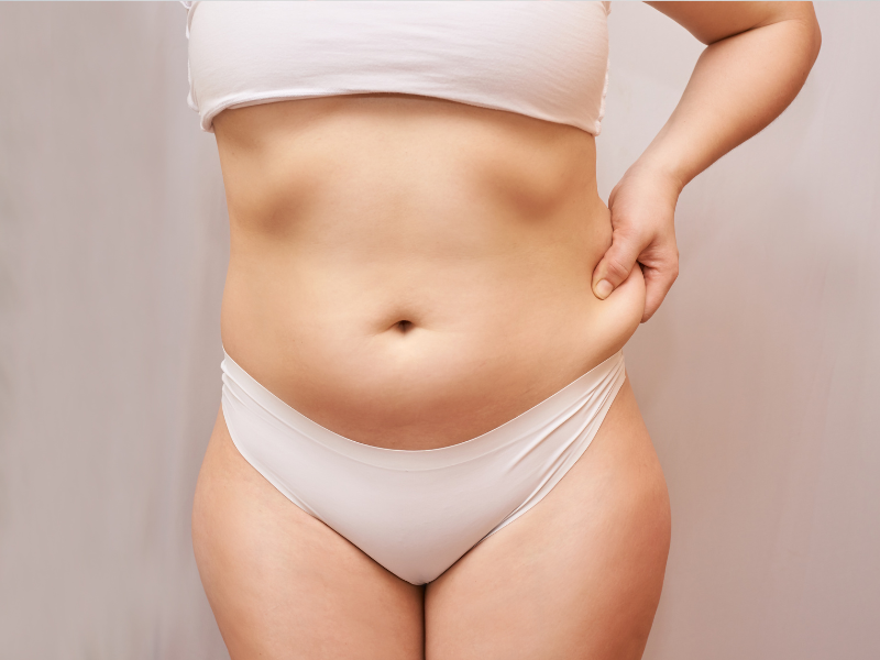 Health Implications of Excess Skin and Fat