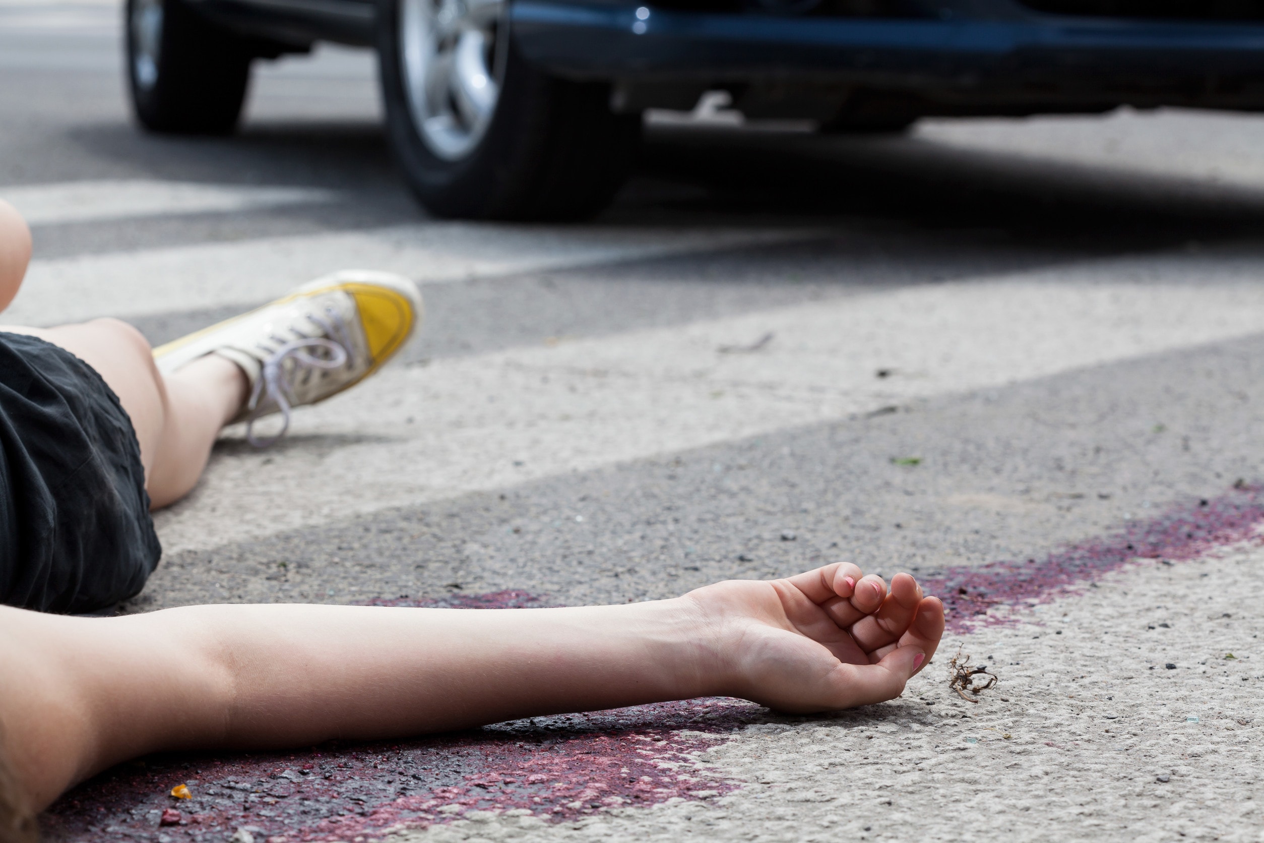 A man lays unconscious on a crossing after being hit by a car