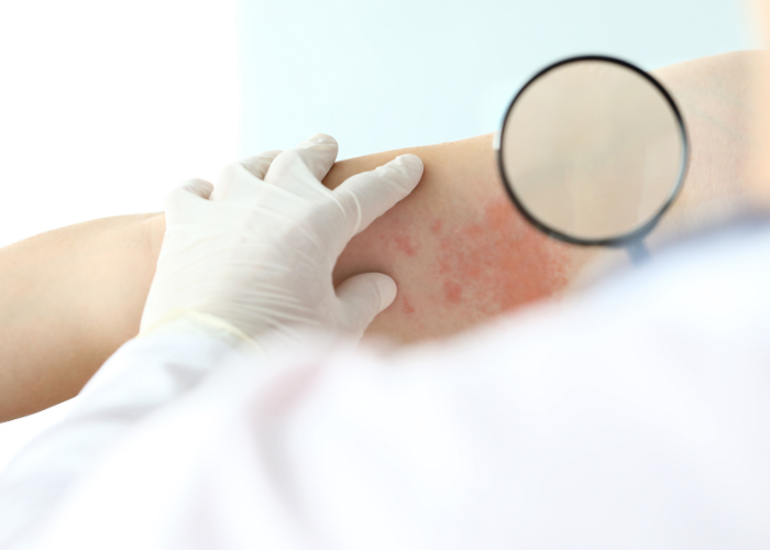 dermatólogo examinando manchas en la piel