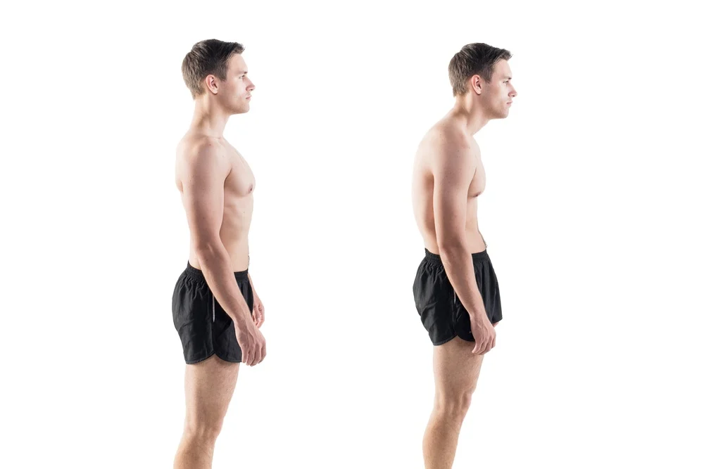 Understanding Posture and Its Importance