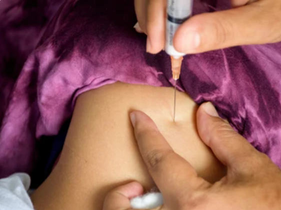 Contraceptive injection, an effective way of birth control.