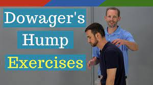 Dowager's Hump Exercises (AKA Hyperkyphosis) - YouTube