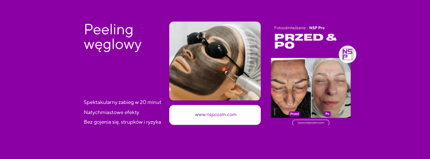 peeling węglowy laserem kosmetolog