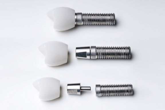 a titanium screw, implant abutment and dental implant crown shown in the stages of assembly