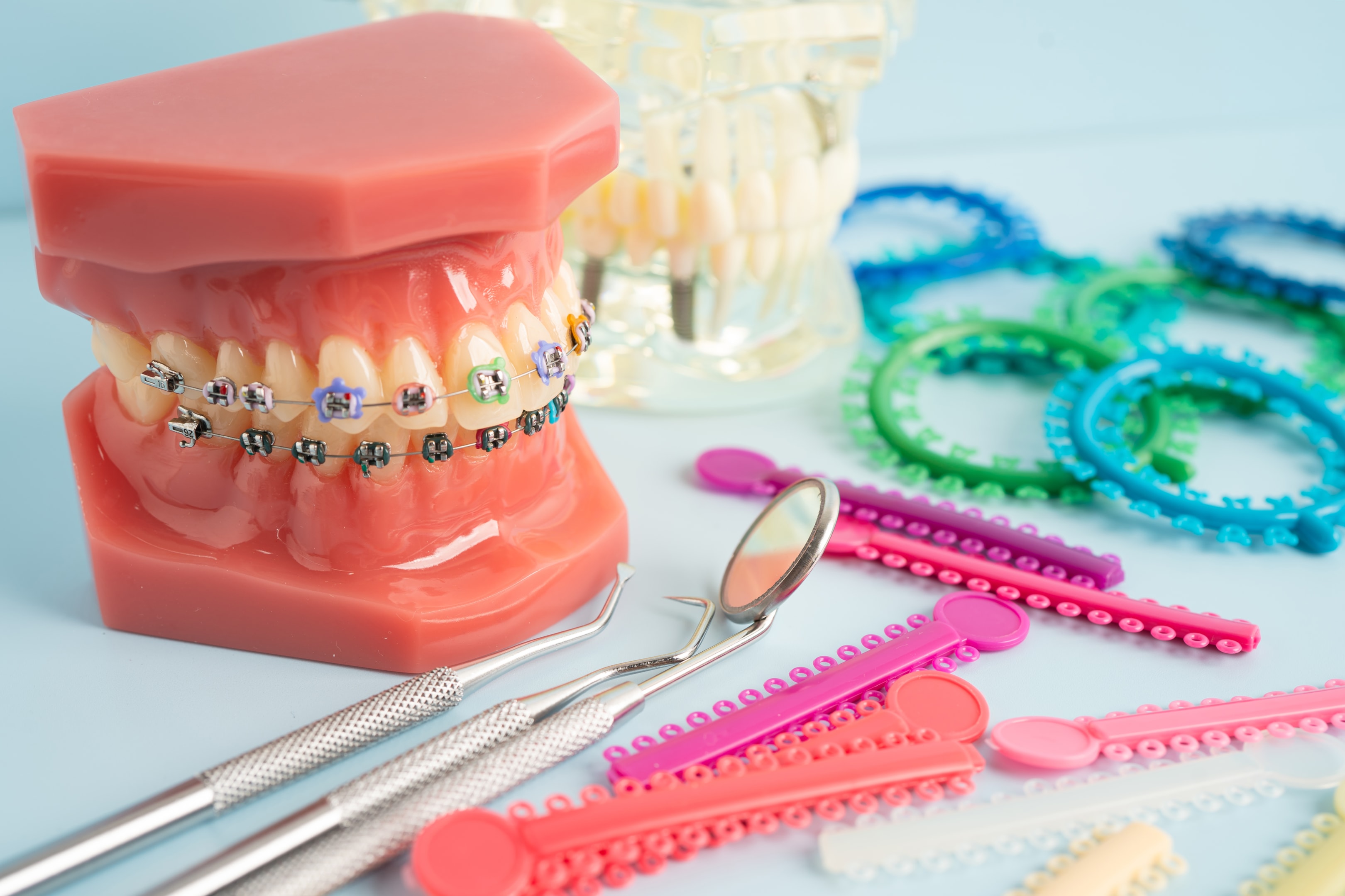 traditional braces figure contrasting invisalign for teens