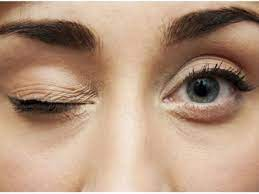 Eye twitching causes and how to treat it - Royal Spanish Center