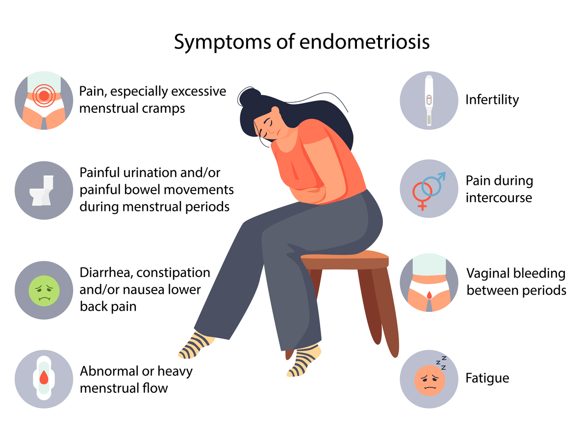 A chart that lists the symptoms of endometriosis including pain, excessive menstrual period cramps, heavy flow, back pain, and more