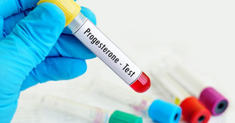 Progesterone Testing and Monitoring