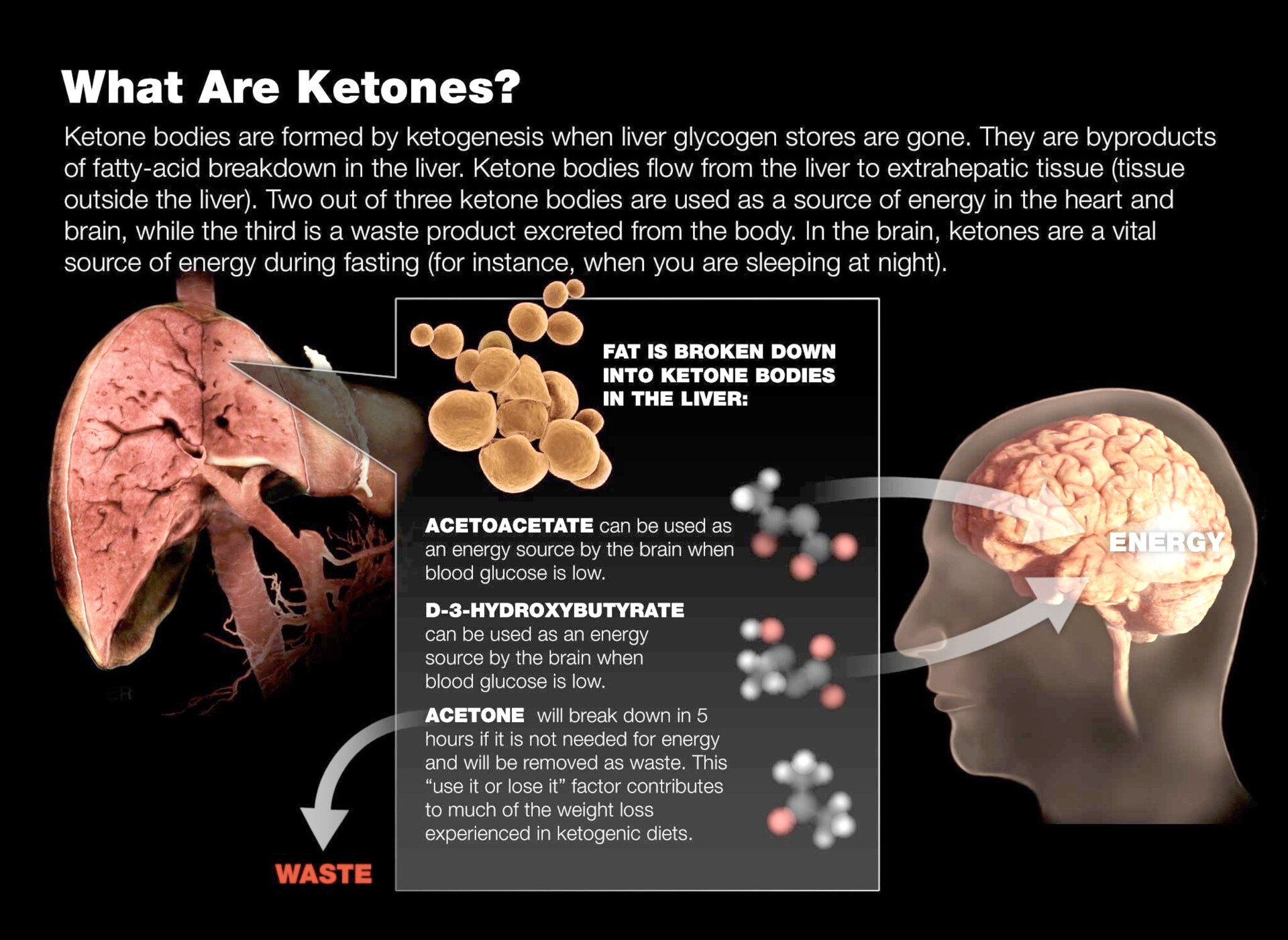 ketones and the brain