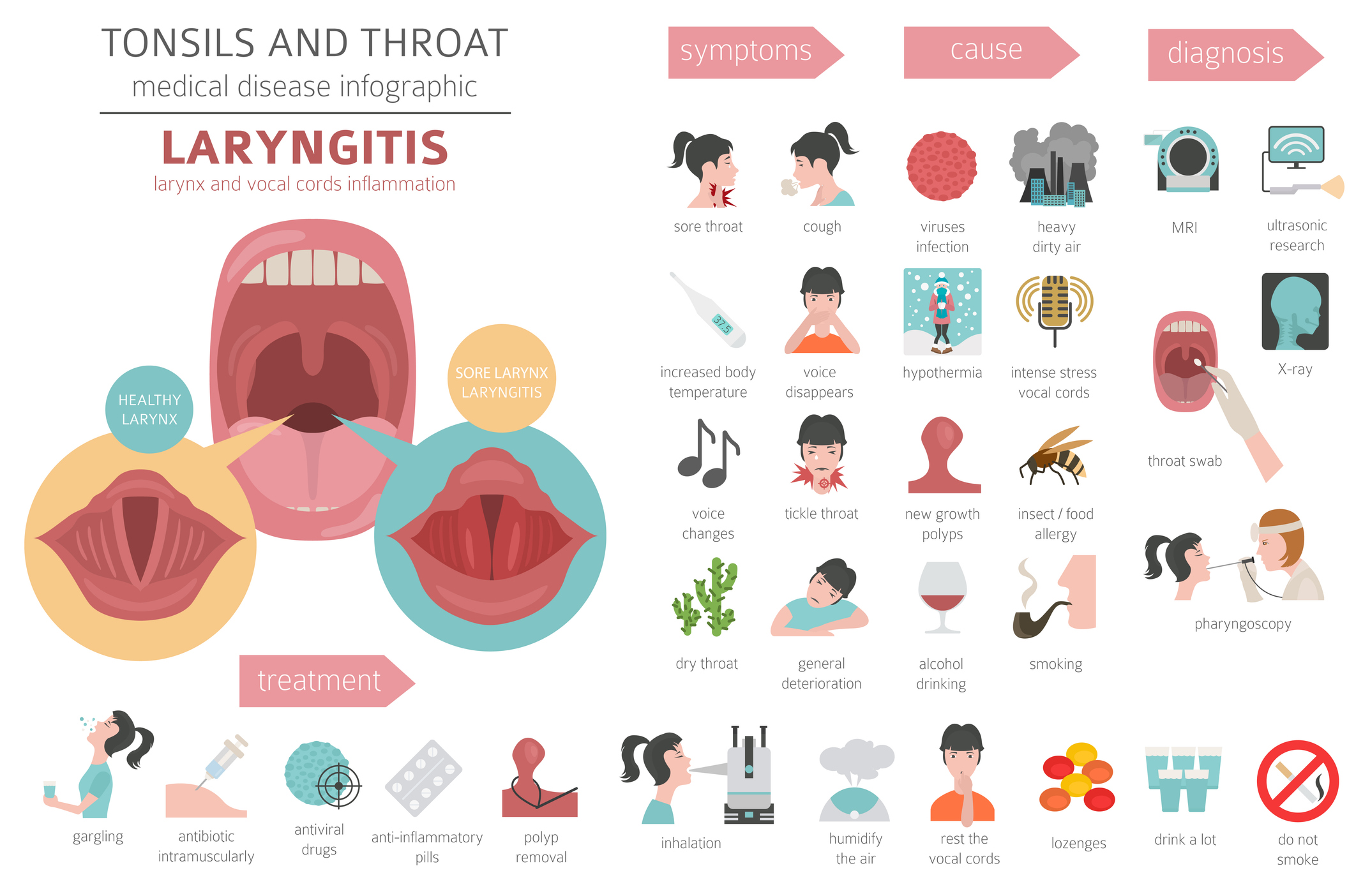 An image of a tonsils and throat infographic with cartoon images depicting various aspects with text described below.