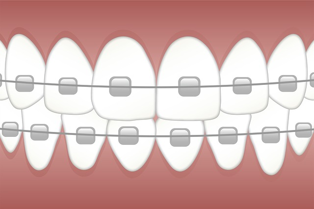 braces, teeth, dentist