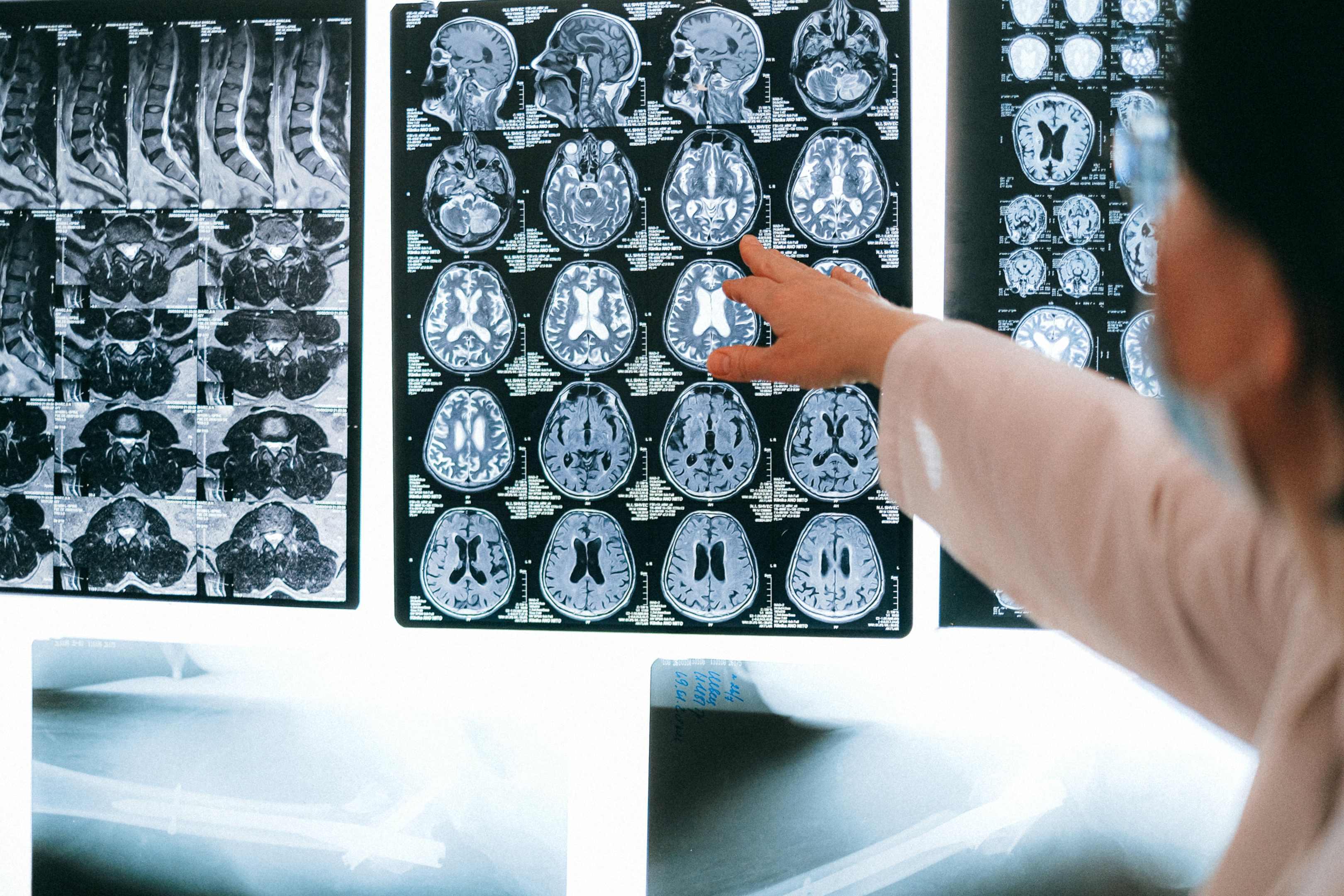 There are Several Forms of Traumatic Brain Injury