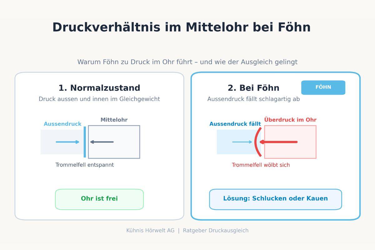 Infografik zu Ohrendruck bei Föhn - Gegenüberstellung von Normalzustand und Druckabfall im Mittelohr mit gewölbtem Trommelfell.