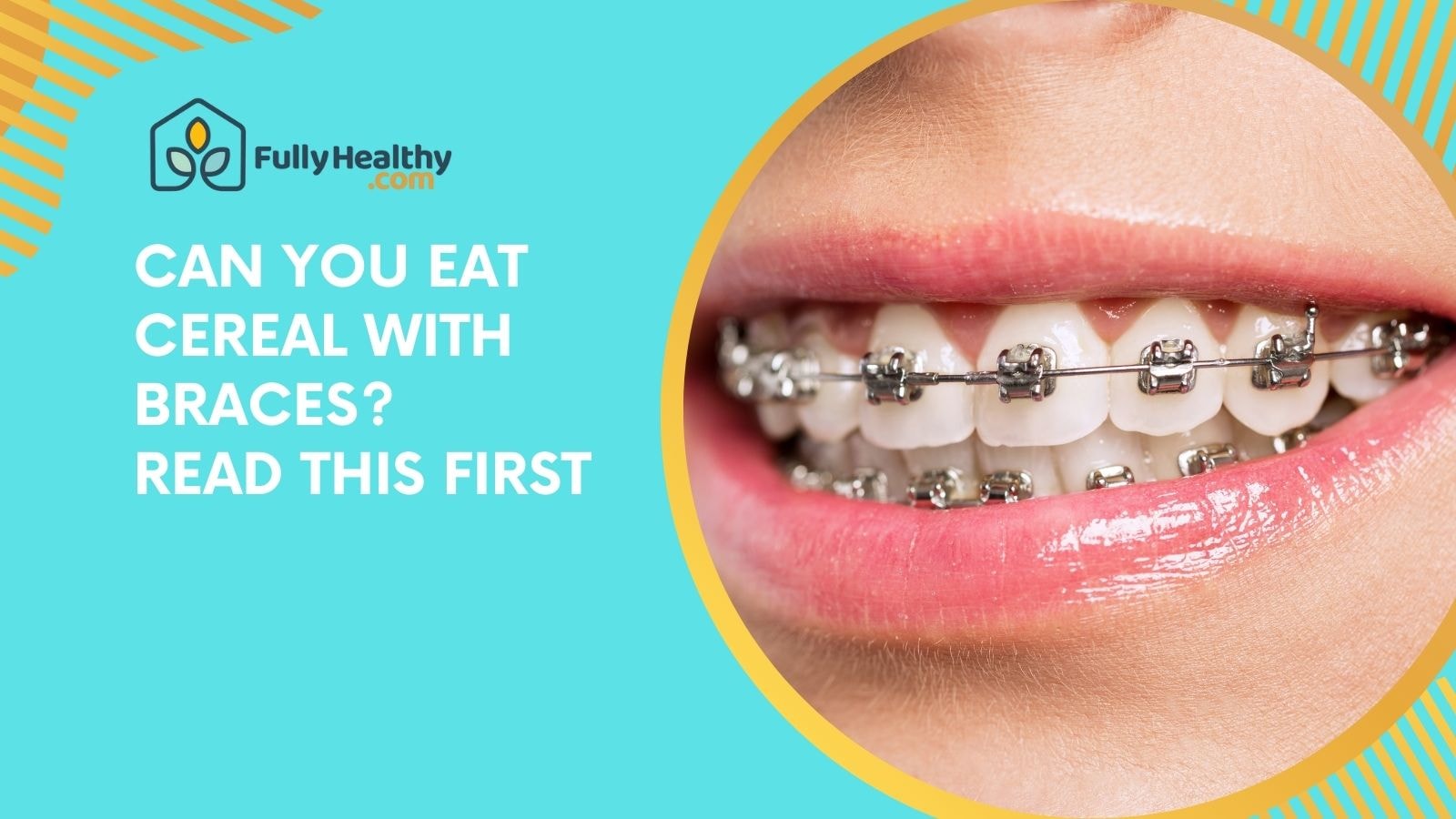 Can You Eat Cereal with Braces? Read This First
