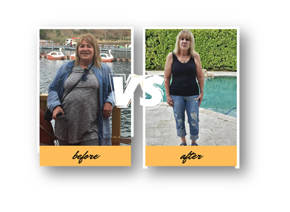 MyConciergeMD | GHK-Cu Peptide Therapy in Los Angeles