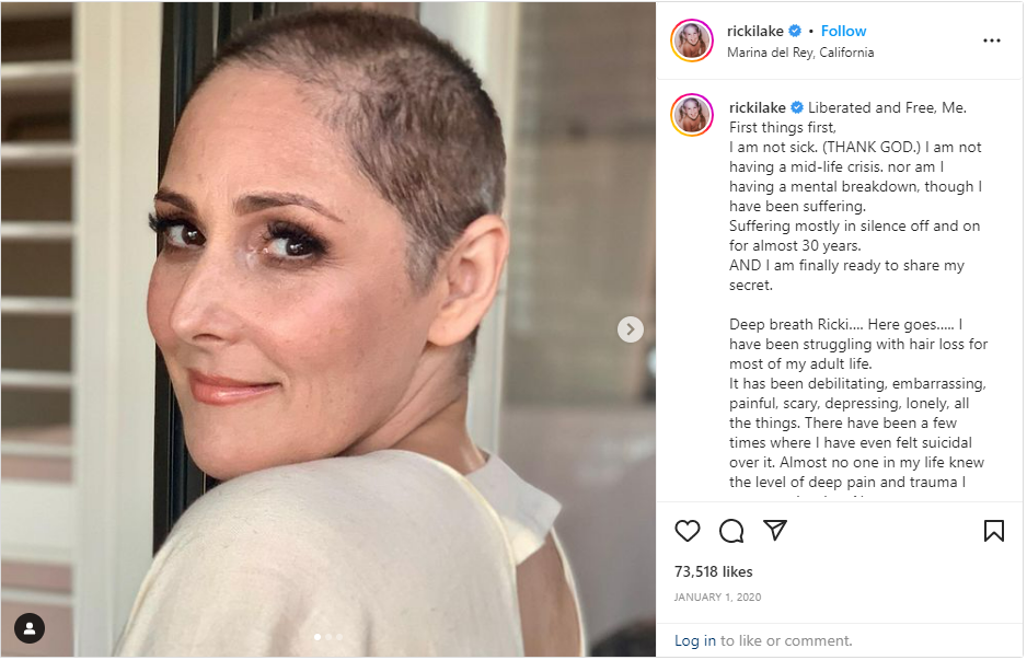 ricki lake hair loss