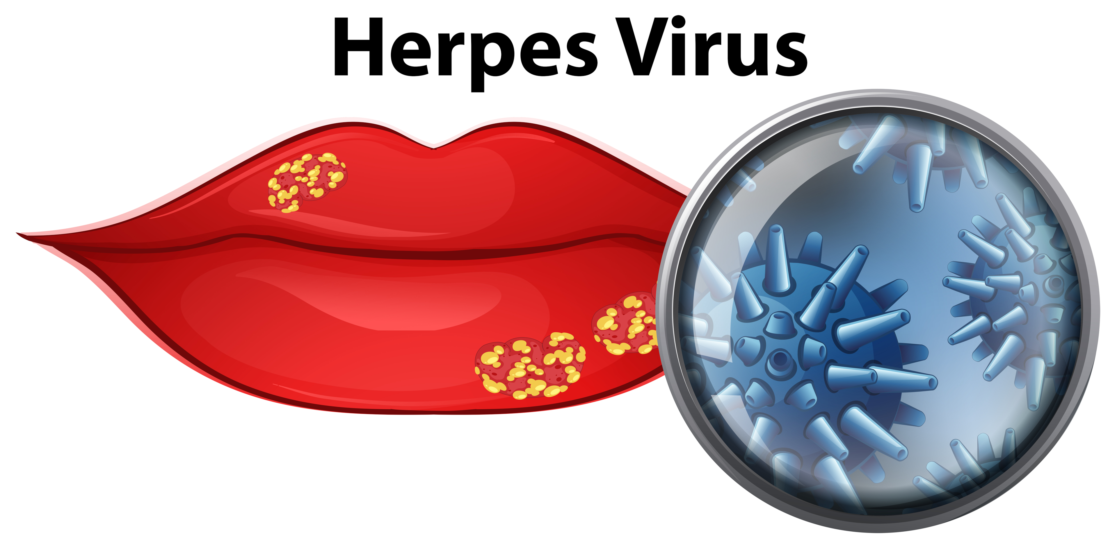 Herpes virus has a special love for your lips.