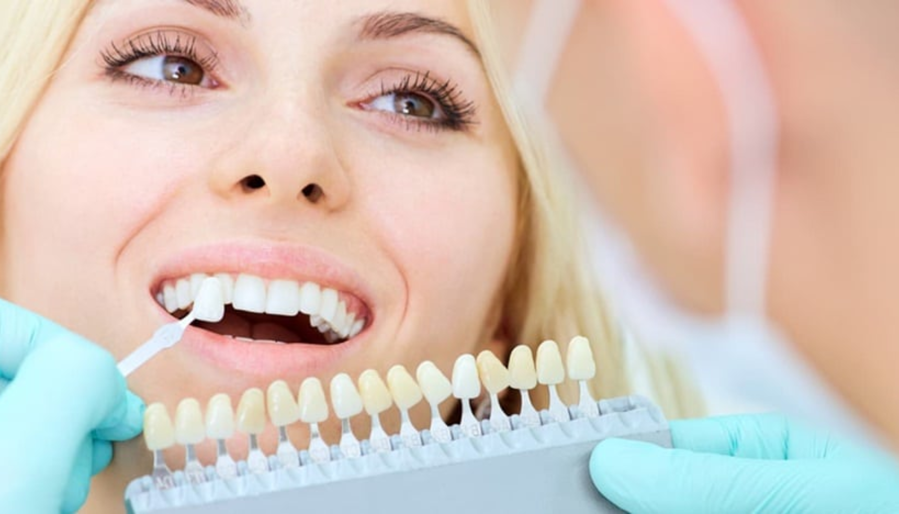 Tannlege sammenligner pasientens tenner med fargeprøver for å finne riktig nyanse til tannbleking eller porselenskrone. Kvinne smiler under vurderingen.