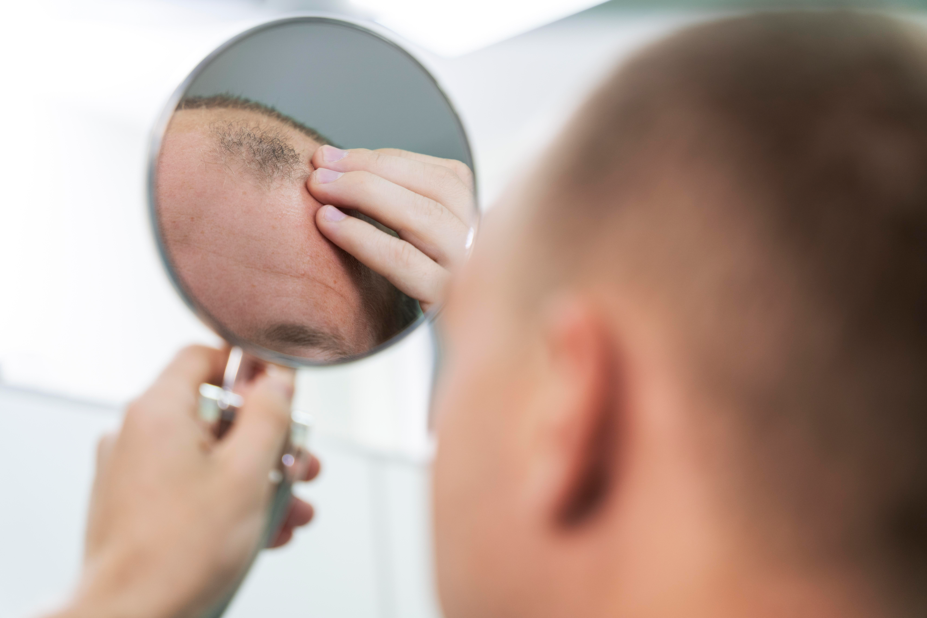 Losing hair very rapidly could be a severe warning sign.