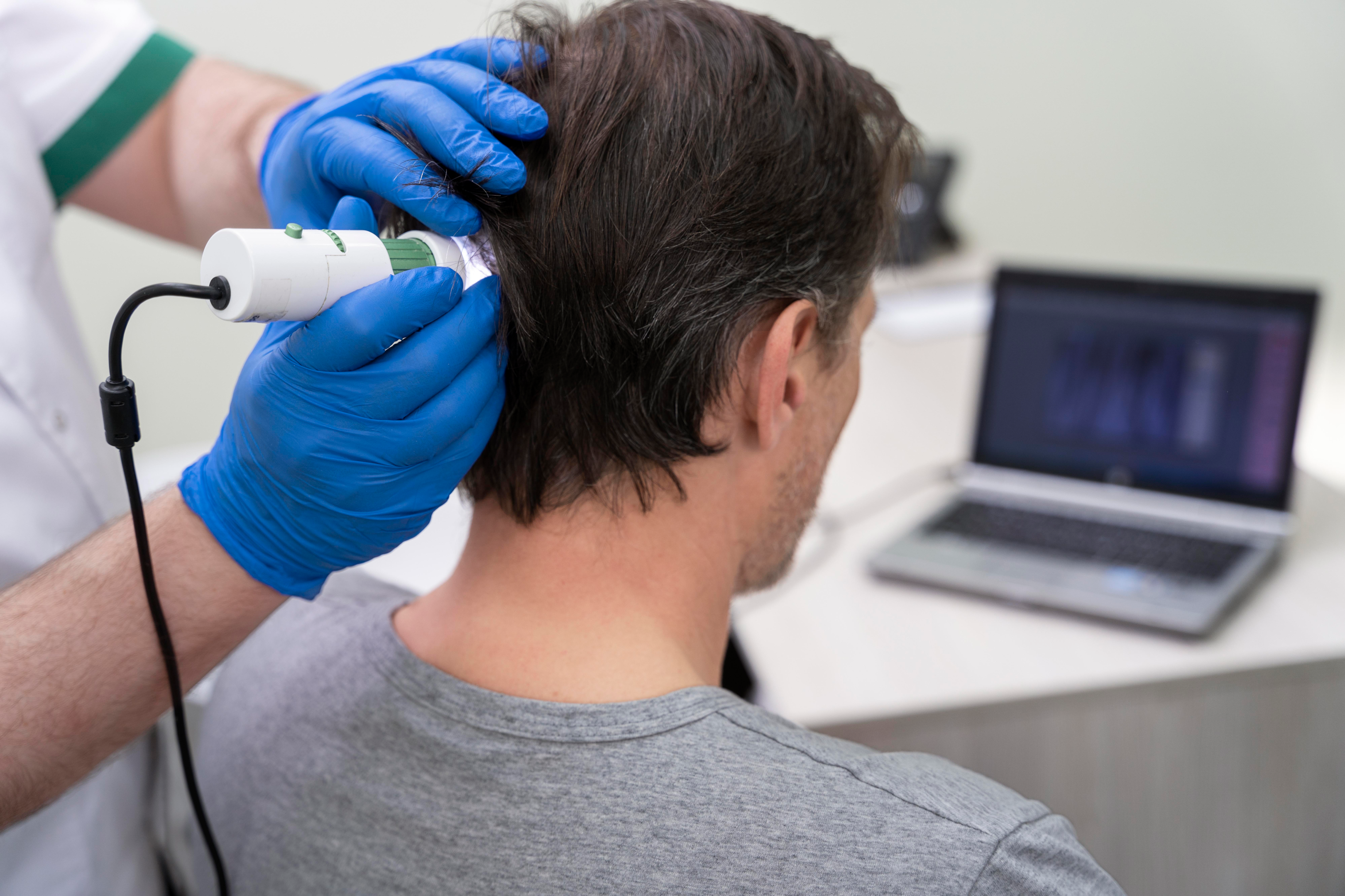 A man receiving laser therapy on the scalp.