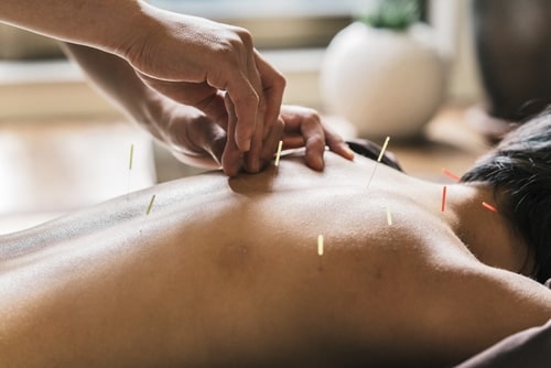 A welcoming image of a wellness journey, featuring a tranquil setting for acupuncture and wellness.