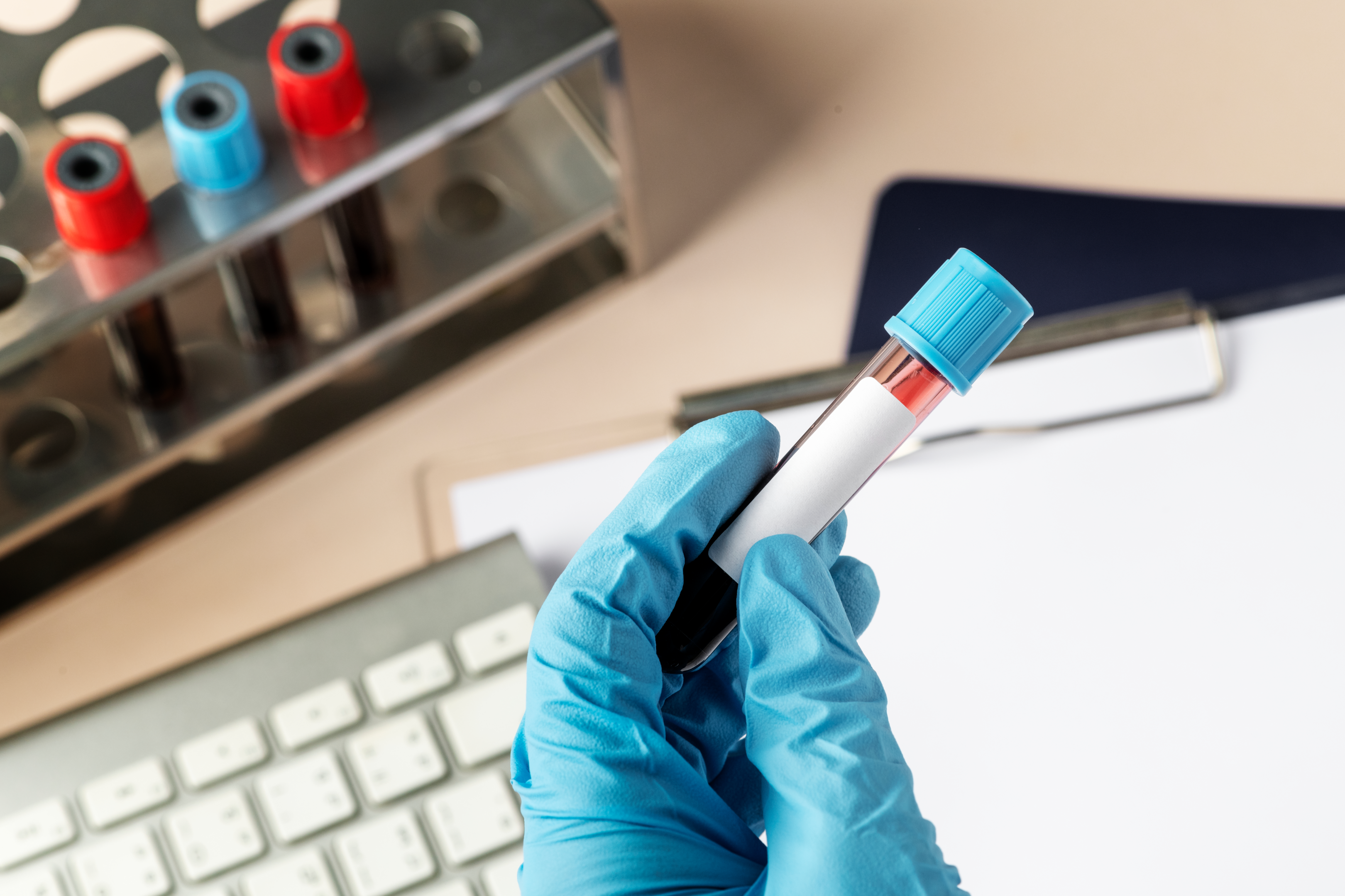 a liver function test ma test for serum bilirubin levels in a blood sample 