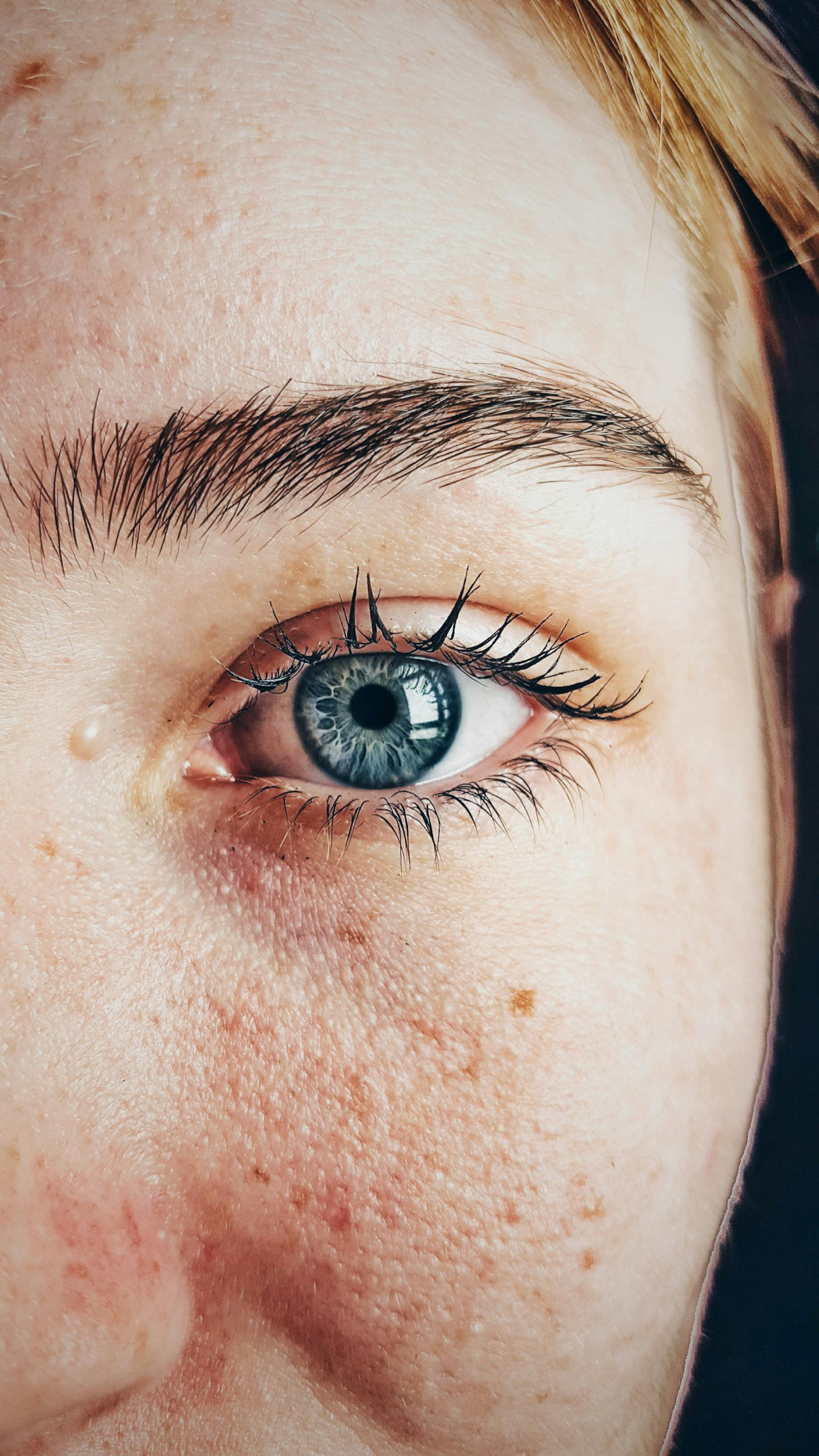 Dry skin around the eyes can affect many different skin types.