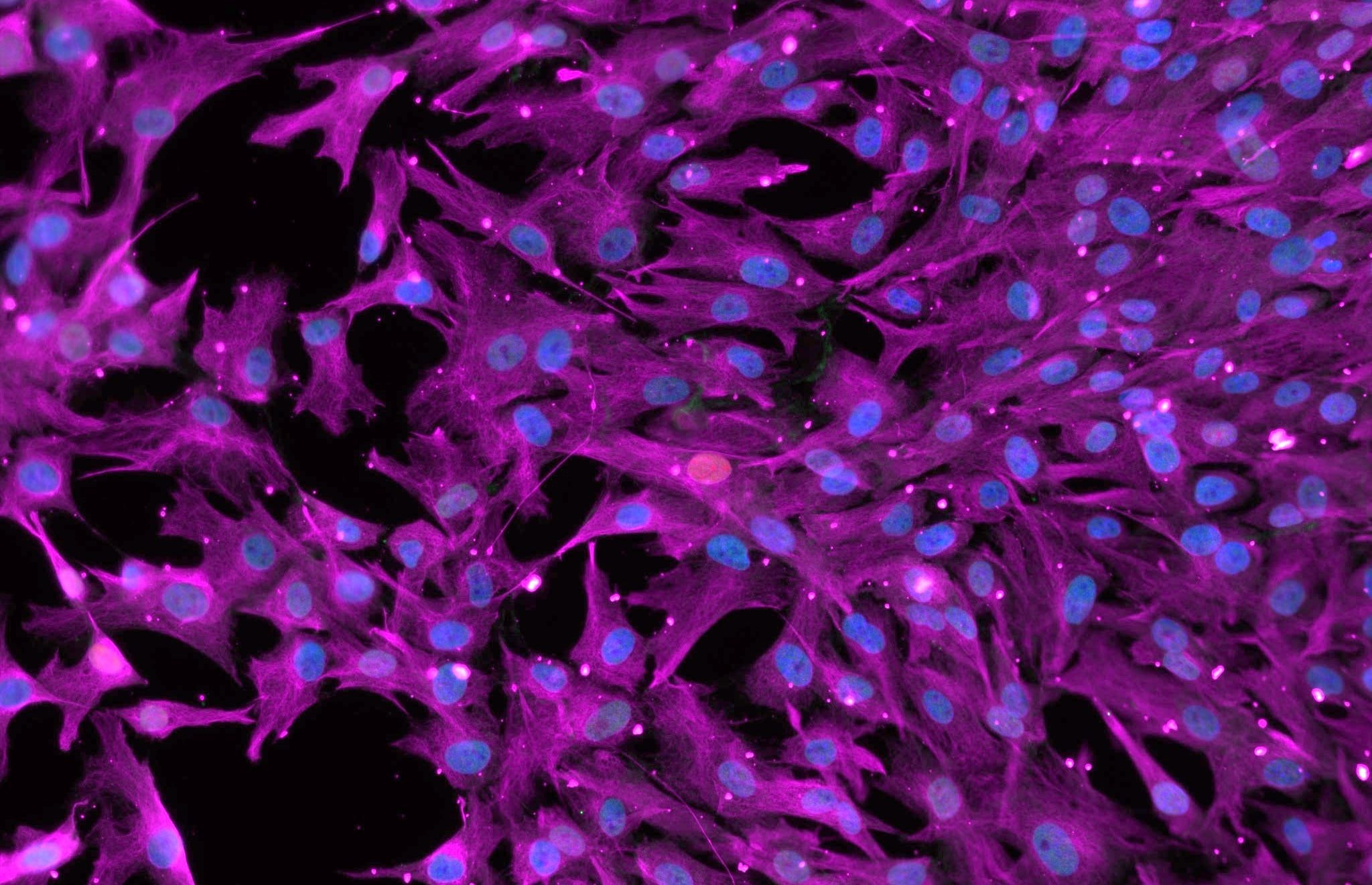 tratamientos-stem-cell-para-alopecia