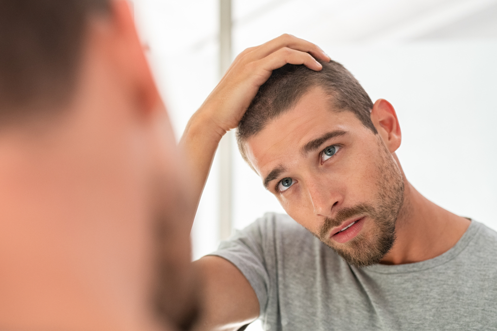 Male pattern balding and hair loss