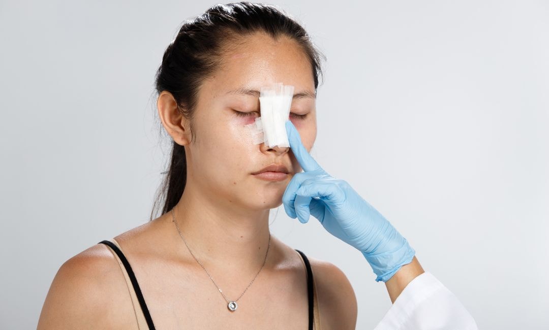 ethnic rhinoplasty procedure