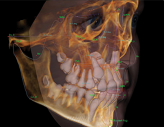 The type of image we use to make your accurate dental, bite and TMJ diagnosis, no blurry x rays here!