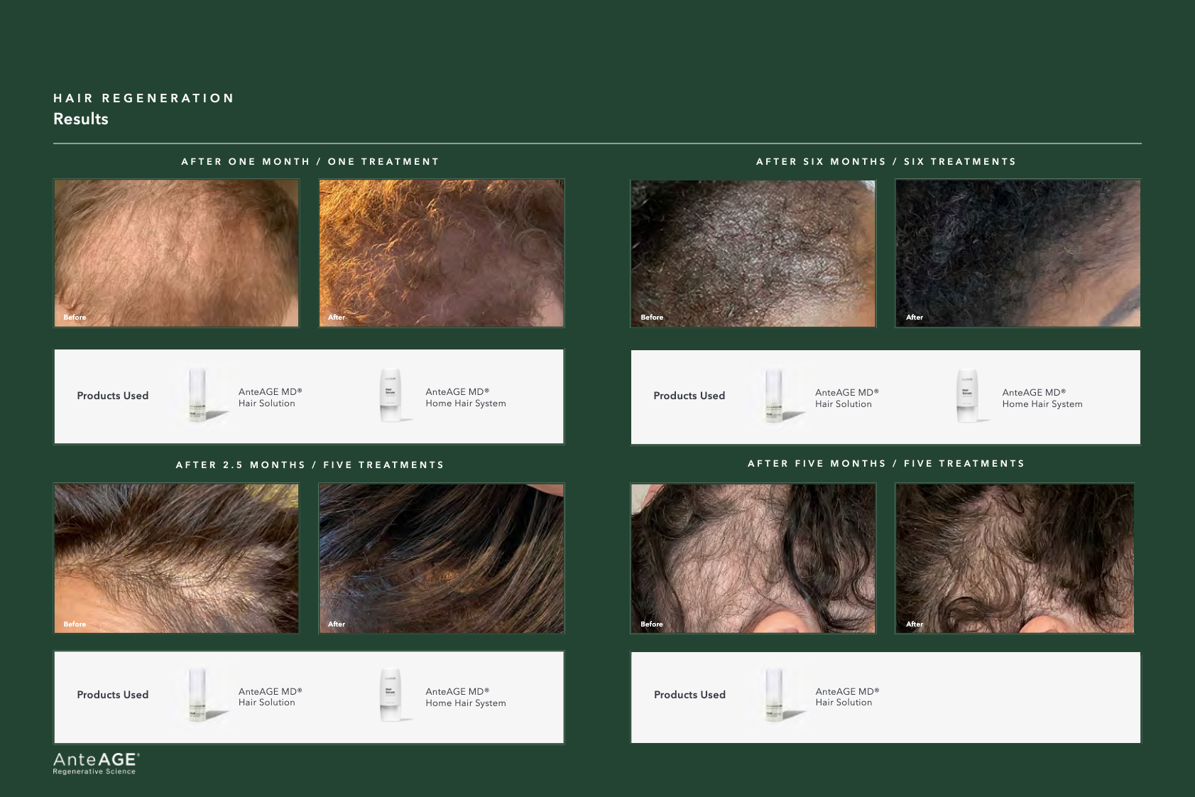 A visual representation of the benefits of exosome hair restoration.