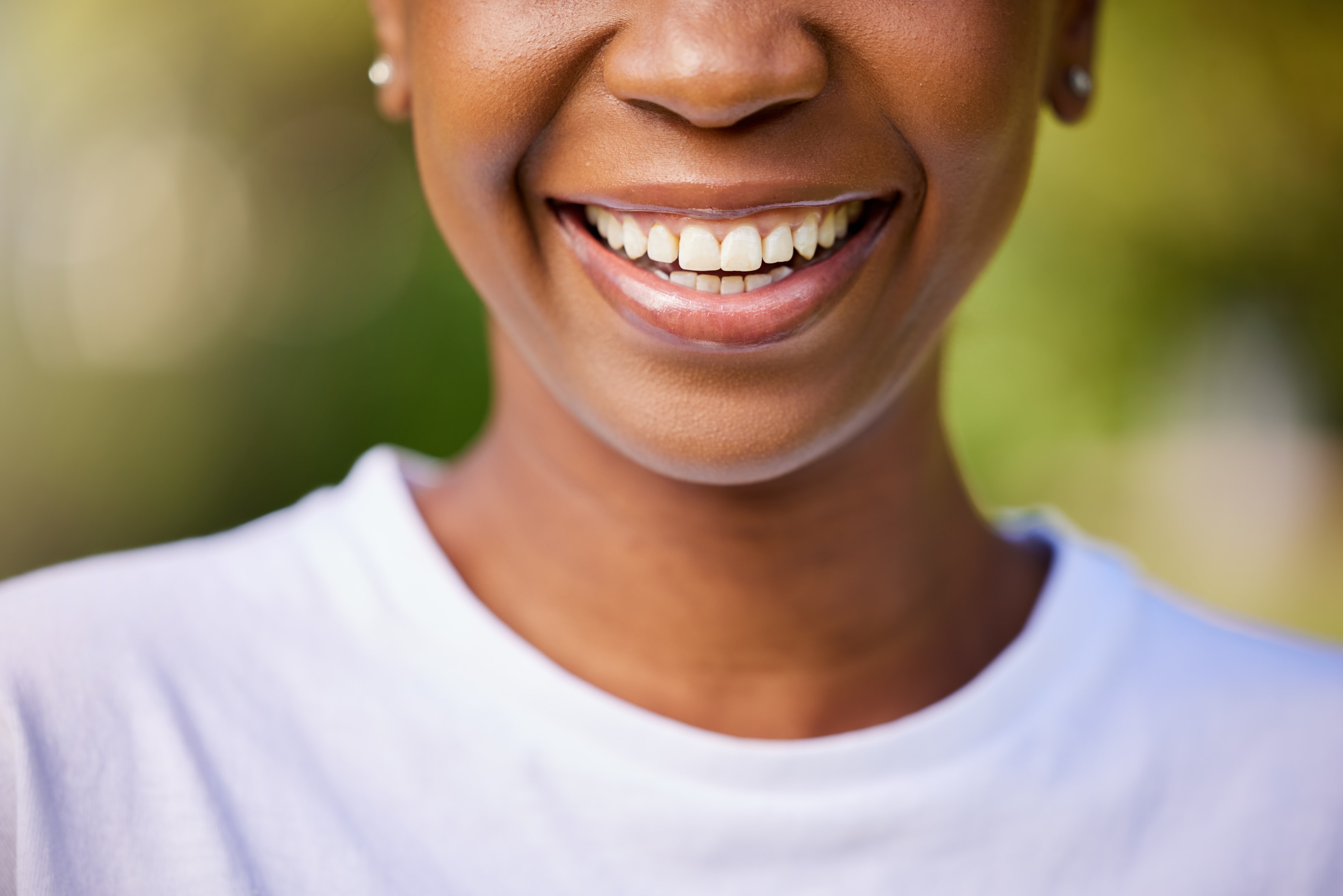 the smile of a woman who is going to receive bone grafts to prepare for dental implant surgery