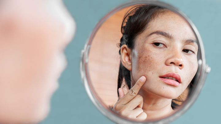 image showcasing a woman looking in the mirror, The Top ingredients that get rid of Hyperpigmentation