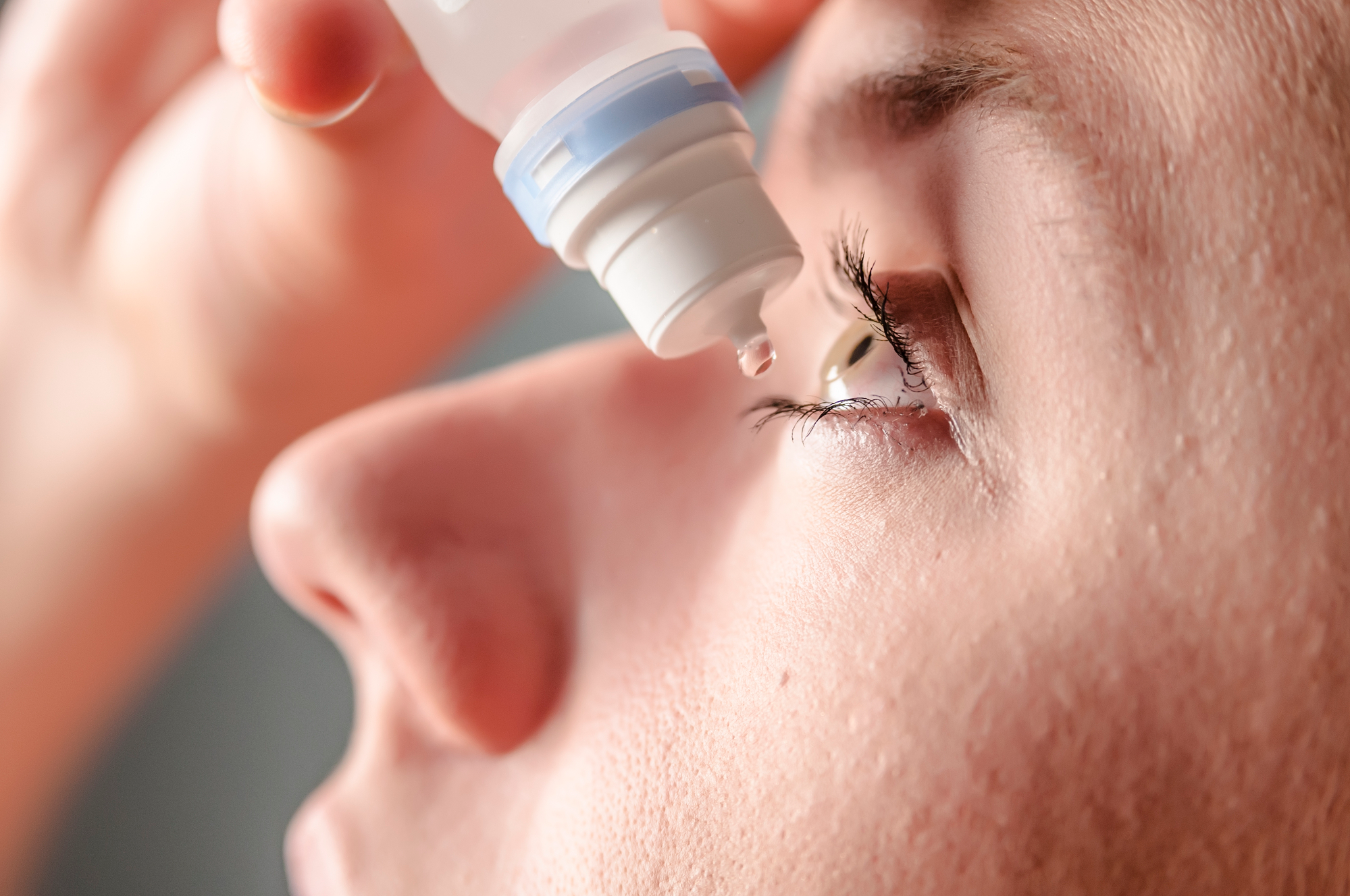 how to not look high without eye drops, how to get rid of stoned eyes fast,