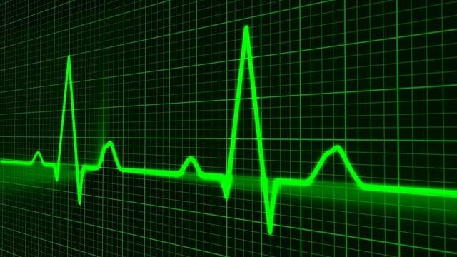 An image of green heartbeat lines on a machine. 