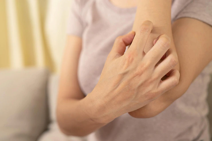 Itchy skin during menopause affects the skin of the face, arms, elbows, legs and genital area.