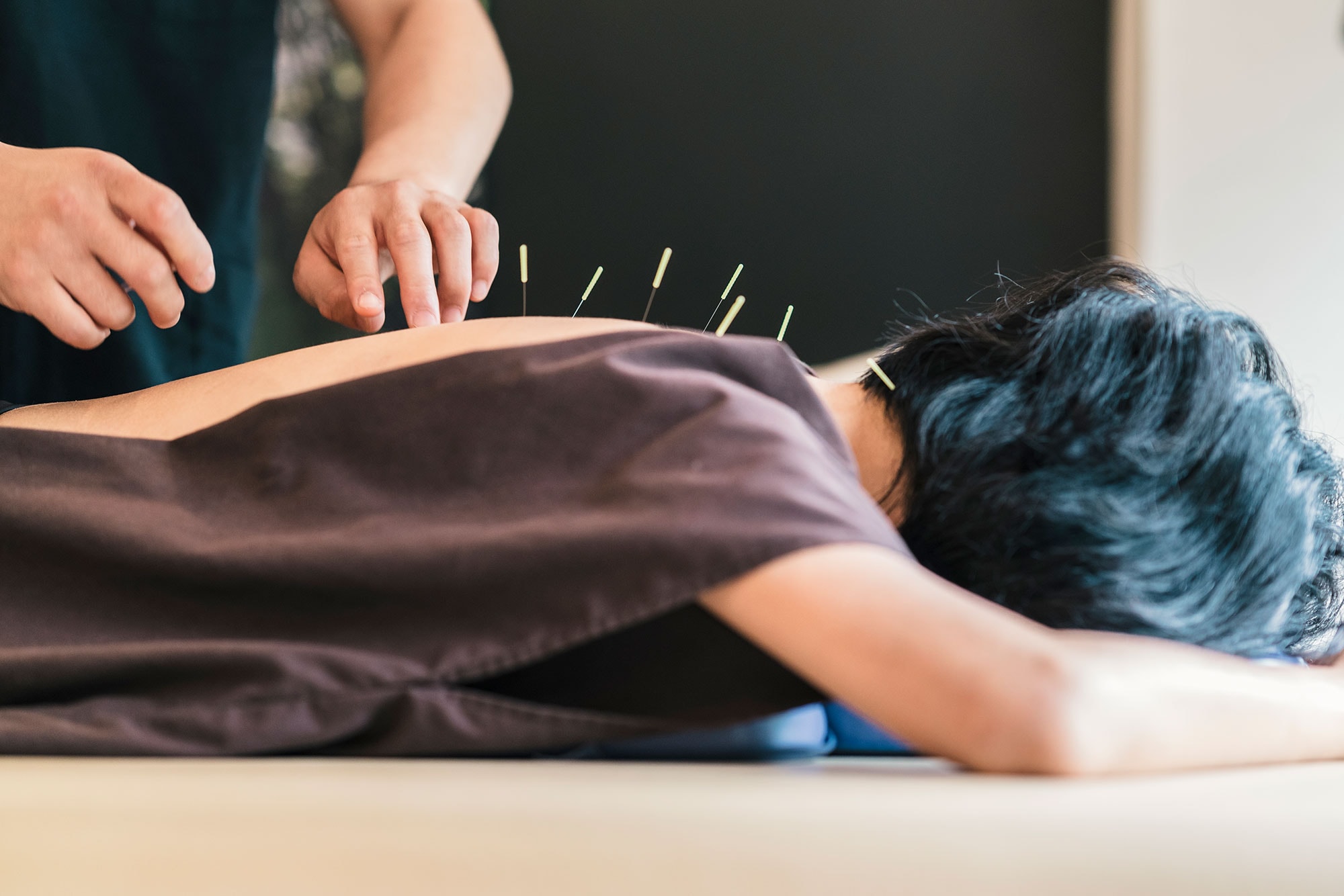 A visual representation of common conditions treated with acupuncture, featuring acupuncture needles and herbs.