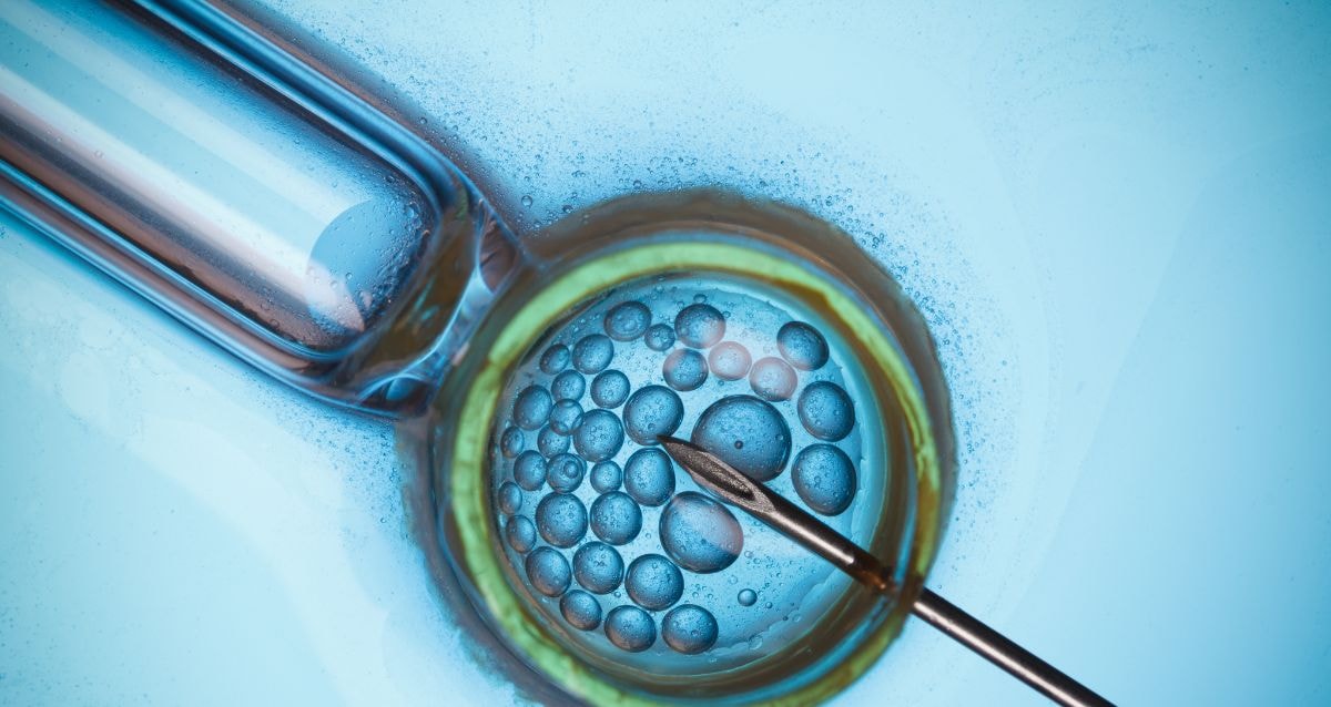 IVF involves using the intended mother's egg or a doner egg