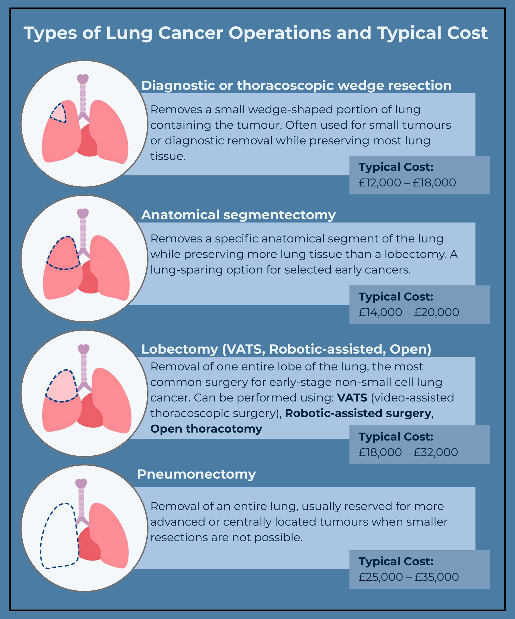 Types of Lung Cancer Operations and Typical Cost