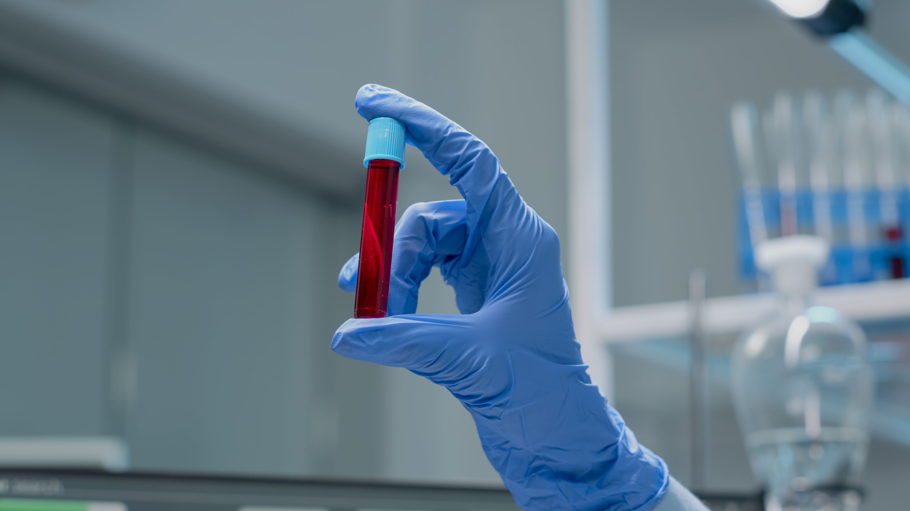 Various factors can compromise the quality of blood tests.