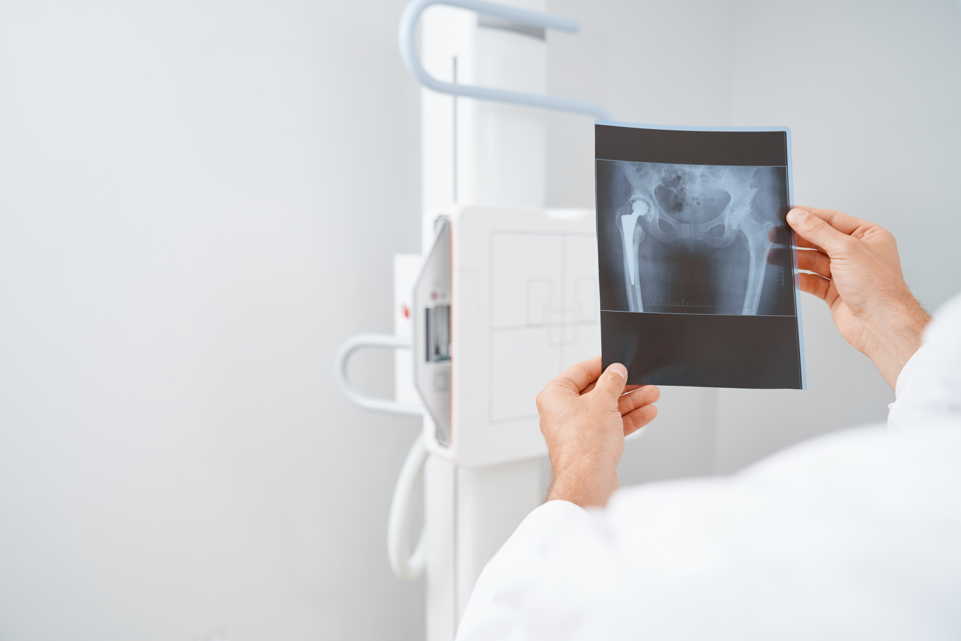 The X-ray analysis helps the doctor to determine bone density.